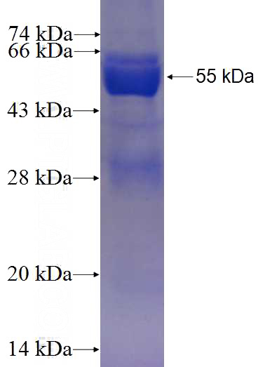 Recombinant Human PSMB4 SDS-PAGE