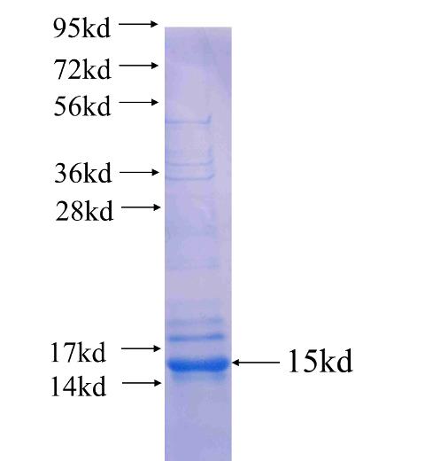 Recombinant human SLC11A2 SDS-PAGE
