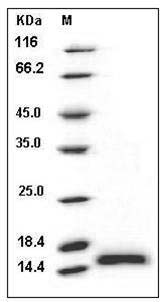 Human PHPT1 / PHP14 Protein (His Tag) SDS-PAGE