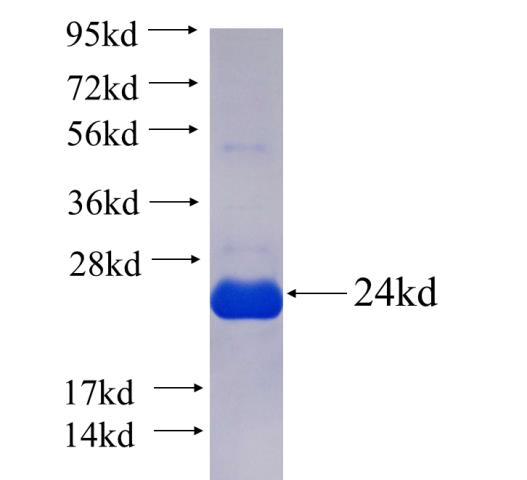 Recombinant human TAF12(Full length) SDS-PAGE