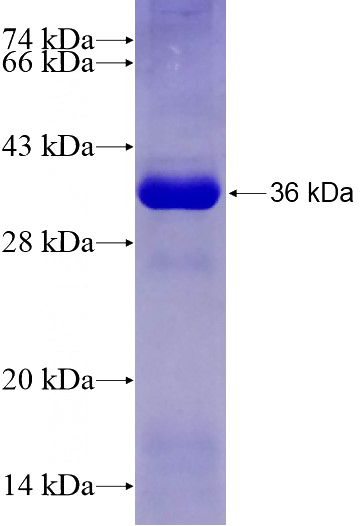 Recombinant Human TTC12 SDS-PAGE