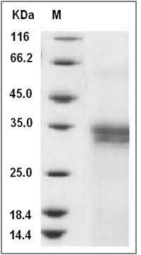 Human IFI30 Protein (His Tag) SDS-PAGE