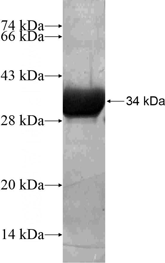 Recombinant Human TLE4 SDS-PAGE