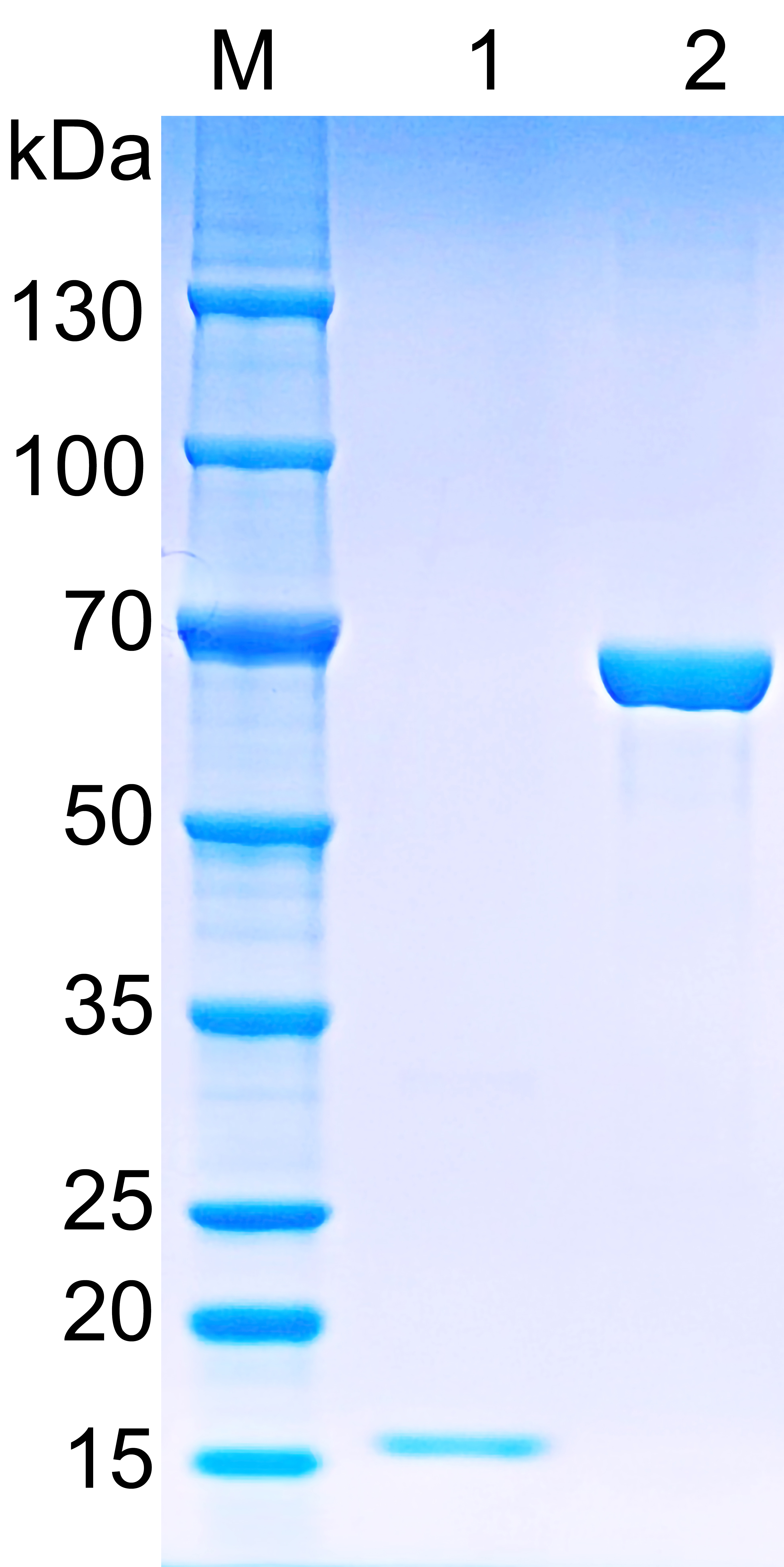 Recombinant Human SPTB SDS-PAGE