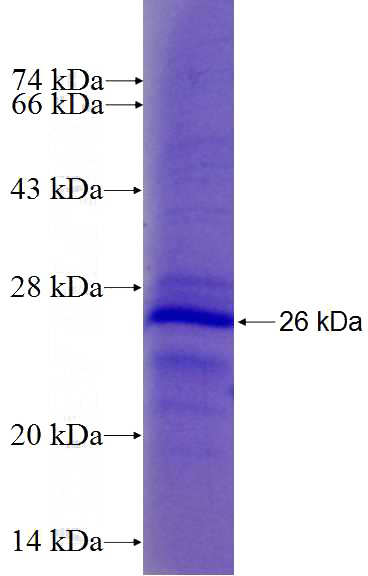 Recombinant Human TXNIP SDS-PAGE