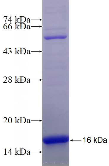 Recombinant Human SH3BGRL2 SDS-PAGE