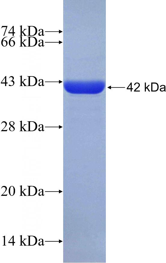 Recombinant Human ZHX3 SDS-PAGE
