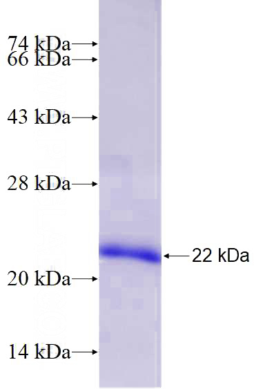 Recombinant Human EZH1 SDS-PAGE