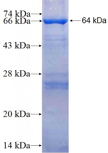 Recombinant Human ECT2 SDS-PAGE