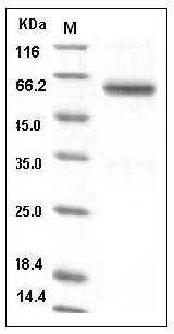 Human TNFR1 / CD120a / TNFRSF1A Protein (His & Fc Tag) SDS-PAGE