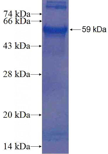 Recombinant Human EFEMP2 SDS-PAGE