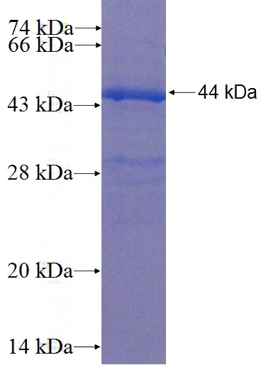 Recombinant Human SLCO5A1 SDS-PAGE