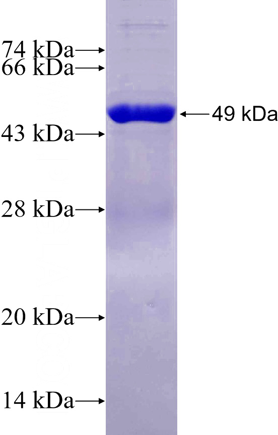 Recombinant Human SARM1 SDS-PAGE