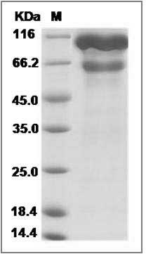 Human LOXL2 / Lysyl oxidase homolog 2 Protein (His Tag)
