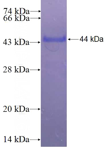 Recombinant Human ARHGAP6 SDS-PAGE