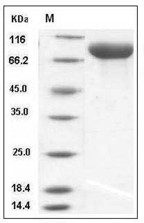 Rat gp130 / IL6ST / CD130 Protein (His Tag) SDS-PAGE