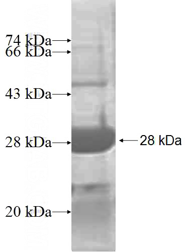 Recombinant Human ARL4D SDS-PAGE