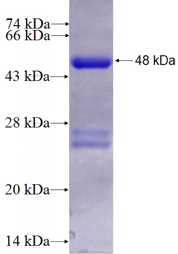 Recombinant Human RHOC SDS-PAGE