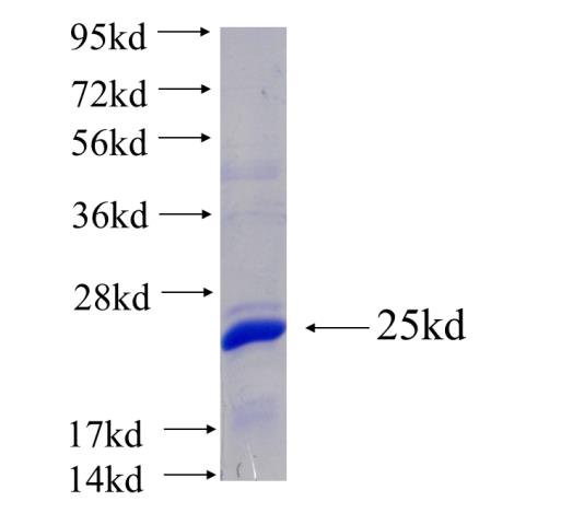 Recombinant human SPATA19(Full length) SDS-PAGE