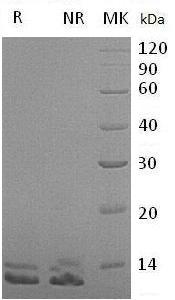 Human SPINK7/ECG2/UNQ745/PRO1474 (His tag) recombinant protein
