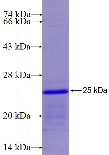 Recombinant Human EMID1 SDS-PAGE