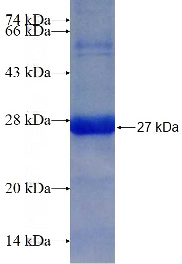 Recombinant Human RAB18 SDS-PAGE