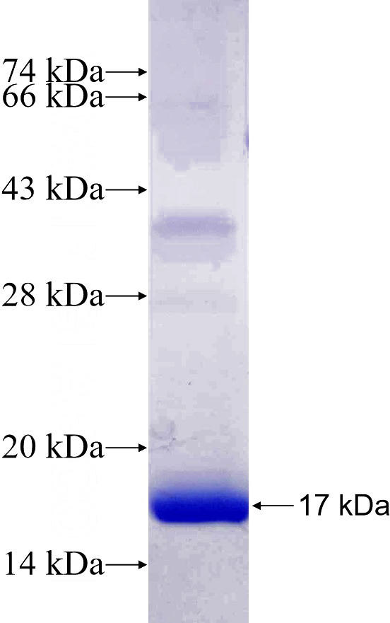 Recombinant Human DDIT4L SDS-PAGE