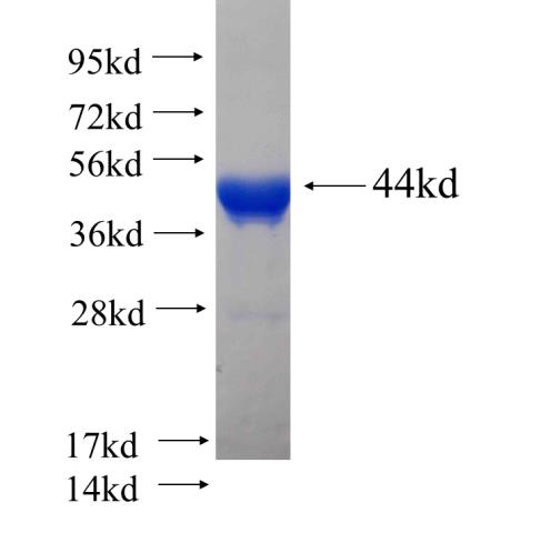 Recombinant human KTN1 SDS-PAGE