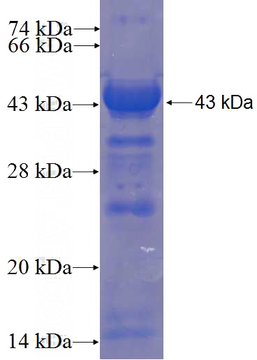 Recombinant Human KIF14 SDS-PAGE