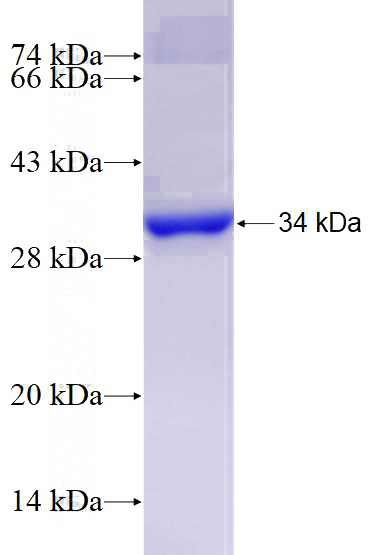 Recombinant Human FOXG1 SDS-PAGE