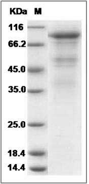 Rat VE-Cadherin / CD144 / CDH5 Protein (His Tag) SDS-PAGE