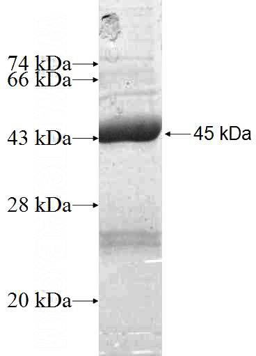 Recombinant Human SAT2 SDS-PAGE