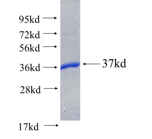 Recombinant human NIT2(Full length) SDS-PAGE