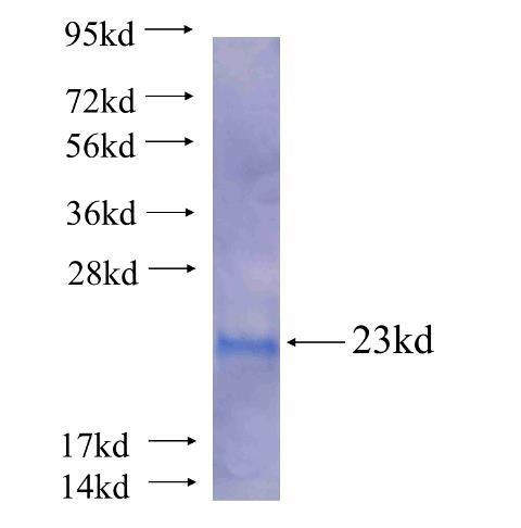 Recombinant human HSPB6(Full length) SDS-PAGE