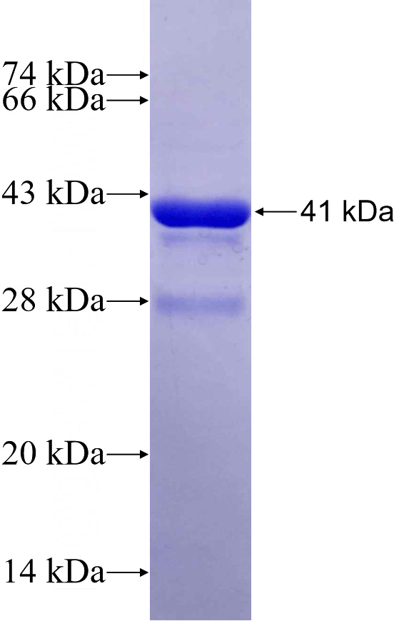 Recombinant Human ABR SDS-PAGE