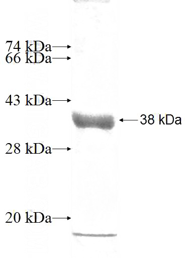 Recombinant Human LSM7 SDS-PAGE