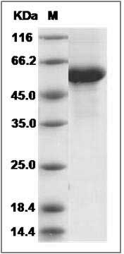 Rat CD70 / CD27L / TNFSF7 Protein (Fc Tag) SDS-PAGE