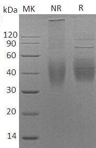Human CD244/2B4 (His tag) recombinant protein