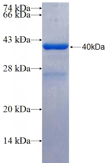 Recombinant Human KIF20B SDS-PAGE