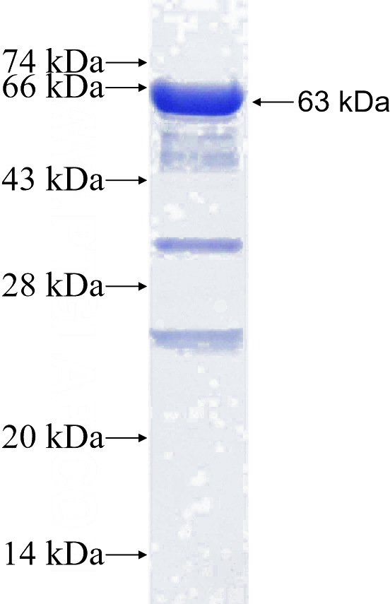 Recombinant Human SYTL4 SDS-PAGE