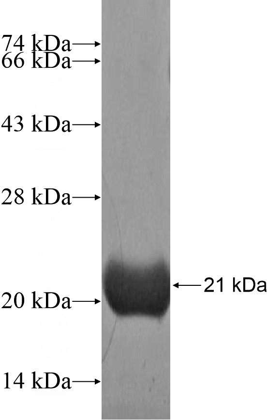 Recombinant Human TLL2 SDS-PAGE