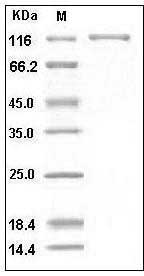 Human G-CSFR / CD114 / CSF3R Protein (Fc Tag) SDS-PAGE