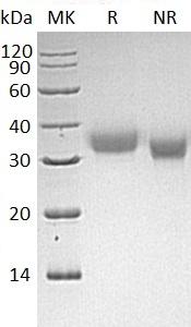 Human CEACAM21/UNQ3098/PRO10075 (His tag) recombinant protein