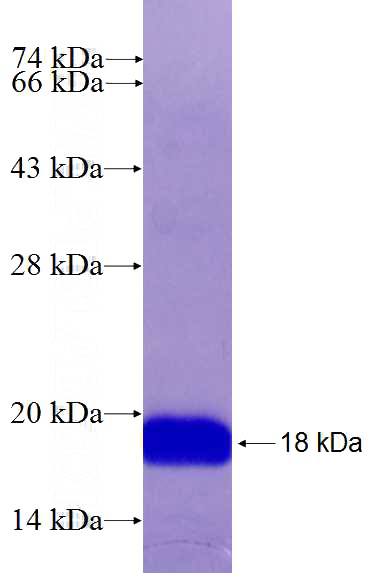 Recombinant Human HLA-E SDS-PAGE