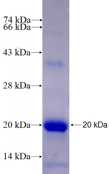 Recombinant Human L3MBTL3 SDS-PAGE