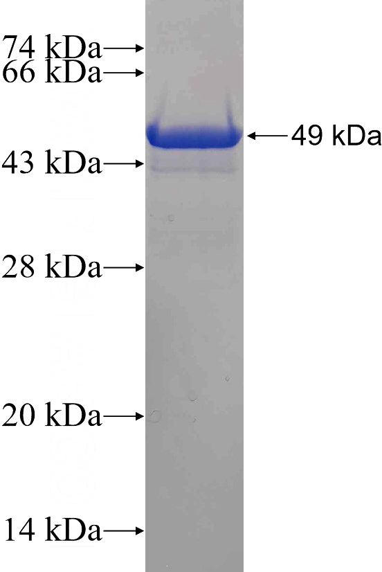 Recombinant Human CHRNA3 SDS-PAGE