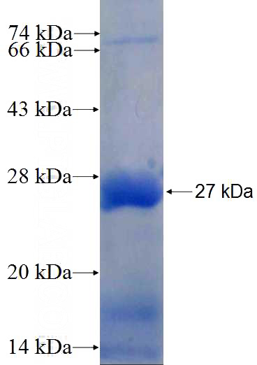 Recombinant Human C16orf73 SDS-PAGE