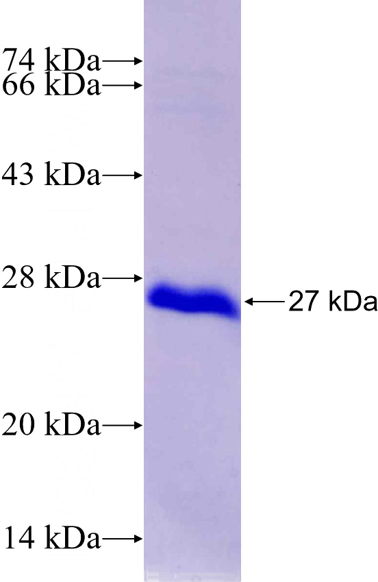Recombinant Human CABP7 SDS-PAGE