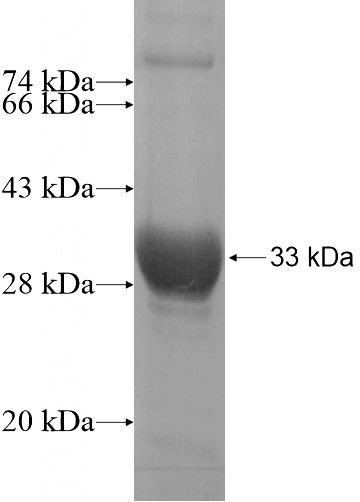 Recombinant Human SPIN2A SDS-PAGE