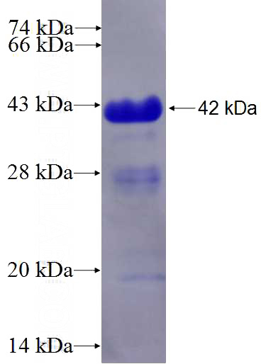 Recombinant Human RCAN1 SDS-PAGE